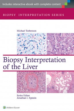 Biopsy Interpretation Of The Liver Pdf Dr Notes